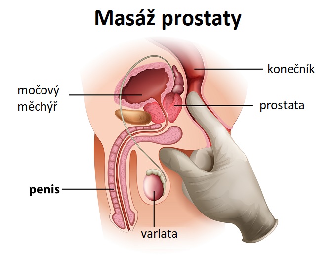 Masáž prostaty – mužský bod-G